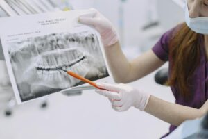 What Happens When Dental Insurance Data Is Breached - Featured image