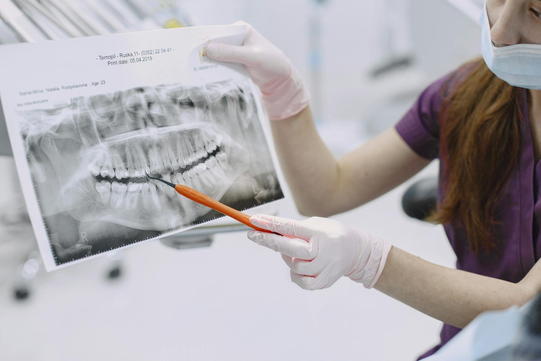 What Happens When Dental Insurance Data Is Breached - Featured image