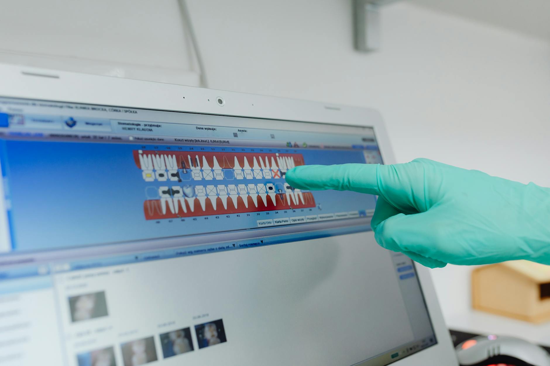 What Information Is Included in Your Treatment Records?